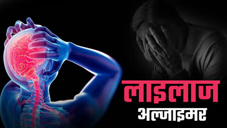 अल्ज़ाइमर पर विशेषज्ञों का बड़ा दावा, बढ़ती आशंकाएं उतनी गंभीर नहीं